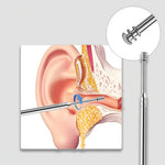 Earwax Remover Set™ | 6-in-1 tool set!