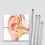 Earwax Remover Set™ | 6-in-1 tool set!